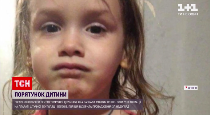 Новини Дніпра - Бабуся спалила 3-річну дитину, врятували сусіди - ВГОЛОС